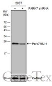 Anti-Park7 / DJ-1 antibody used in Western Blot (WB). GTX132552