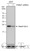 Anti-Park7 / DJ-1 antibody used in Western Blot (WB). GTX132556