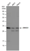 Anti-SMUG1 antibody used in Western Blot (WB). GTX132564