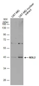 Anti-NEIL2 antibody used in Western Blot (WB). GTX132565