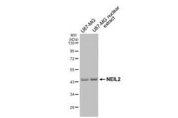 Anti-NEIL2 antibody used in Western Blot (WB). GTX132565