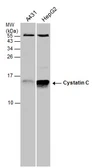 Anti-Cystatin C antibody used in Western Blot (WB). GTX132567