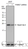 Anti-Park7 / DJ-1 antibody used in Western Blot (WB). GTX132574