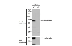 Anti-Optineurin antibody used in Western Blot (WB). GTX132575