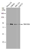 Anti-TBC1D25 antibody used in Western Blot (WB). GTX132577