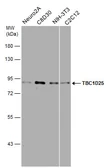 Anti-TBC1D25 antibody used in Western Blot (WB). GTX132577