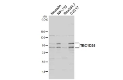 Anti-TBC1D25 antibody used in Western Blot (WB). GTX132577