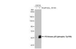 Anti-PI3 kinase p85 (phospho Tyr467)/p55 (phospho Tyr199) antibody used in Western Blot (WB). GTX132597