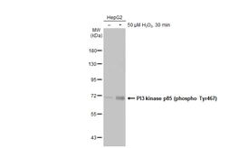 Anti-PI3 kinase p85 (phospho Tyr467)/p55 (phospho Tyr199) antibody used in Western Blot (WB). GTX132597