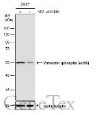 Anti-Vimentin (phospho Ser56) antibody used in Western Blot (WB). GTX132607