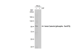 Anti-beta Catenin (phospho Ser675) antibody used in Western Blot (WB). GTX132611