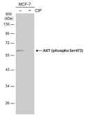 Anti-AKT (phospho Ser473) antibody used in Western Blot (WB). GTX132615