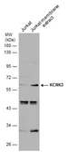 Anti-KCNK3 antibody used in Western Blot (WB). GTX132622