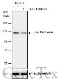Anti-pan Cadherin antibody used in Western Blot (WB). GTX132646