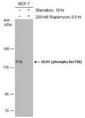 Anti-ULK1 (phospho Ser758) antibody used in Western Blot (WB). GTX132654