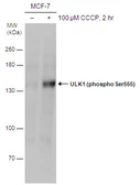 Anti-ULK1 (phospho Ser555) antibody used in Western Blot (WB). GTX132660