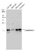 Anti-GABARAPL1 antibody used in Western Blot (WB). GTX132664