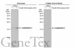 Anti-GABARAPL1 antibody used in Western Blot (WB). GTX132664