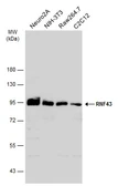 Anti-RNF43 antibody used in Western Blot (WB). GTX132671