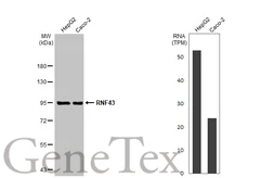 Anti-RNF43 antibody used in Western Blot (WB). GTX132671