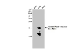 Anti-Human Papillomavirus type 16 E6 antibody used in Western Blot (WB). GTX132686
