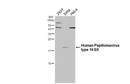 Anti-Human Papillomavirus type 16 E6 antibody used in Western Blot (WB). GTX132686
