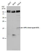 Anti-Human Papilloma virus type 18 E6 antibody used in Western Blot (WB). GTX132687