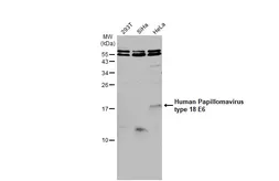 Anti-Human Papillomavirus type 18 E6 antibody used in Western Blot (WB). GTX132687
