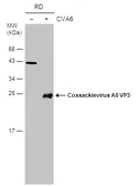 Anti-Coxsackievirus A6 VP3 antibody used in Western Blot (WB). GTX132688