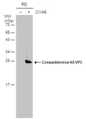 Anti-Coxsackievirus A6 VP3 antibody used in Western Blot (WB). GTX132689