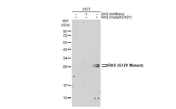Anti-RAS (G12V Mutant) antibody used in Western Blot (WB). GTX132695
