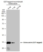 Anti-Osteocalcin antibody used in Western Blot (WB). GTX132703