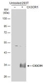 Anti-CX3CR1 antibody used in Western Blot (WB). GTX132714