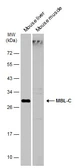 Anti-MBL2 antibody used in Western Blot (WB). GTX132722