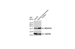 Anti-NDUFA9 antibody used in Western Blot (WB). GTX132726
