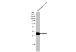 Anti-MPZ antibody used in Western Blot (WB). GTX132747