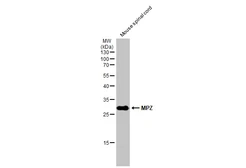 Anti-MPZ antibody used in Western Blot (WB). GTX132761