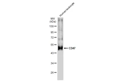 Anti-CD47 antibody used in Western Blot (WB). GTX132762