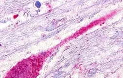 Anti-SREB3 antibody used in IHC (Paraffin sections) (IHC-P). GTX13277