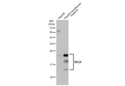 Anti-VEGF antibody used in Western Blot (WB). GTX132777