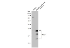 Anti-VEGFA antibody used in Western Blot (WB). GTX132777