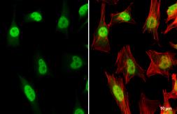Anti-TRF2 antibody used in Immunocytochemistry/ Immunofluorescence (ICC/IF). GTX132780