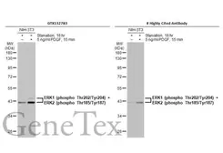 Anti-ERK1 (phospho Thr202/Tyr204) + ERK2 (phospho Thr185/Tyr187) antibody used in Western Blot (WB). GTX132783