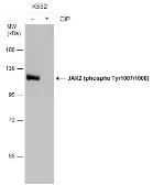 Anti-JAK2 (phospho Tyr1007/1008) antibody used in Western Blot (WB). GTX132784