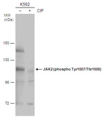 Anti-JAK2 (phospho Tyr1007/1008) antibody used in Western Blot (WB). GTX132785