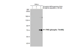 Anti-PKR (phospho Thr446) antibody used in Western Blot (WB). GTX132789