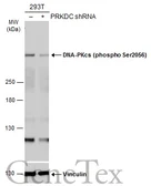 Anti-DNA-PKcs (phospho Ser2056) antibody used in Western Blot (WB). GTX132793