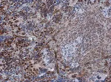 Anti-PDCD4 (phospho Ser457) antibody used in IHC (Paraffin sections) (IHC-P). GTX132798