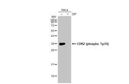 Anti-CDK2 (phospho Tyr15) antibody used in Western Blot (WB). GTX132802