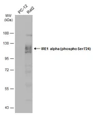 Anti-IRE1 alpha (phospho Ser724) antibody used in Western Blot (WB). GTX132808